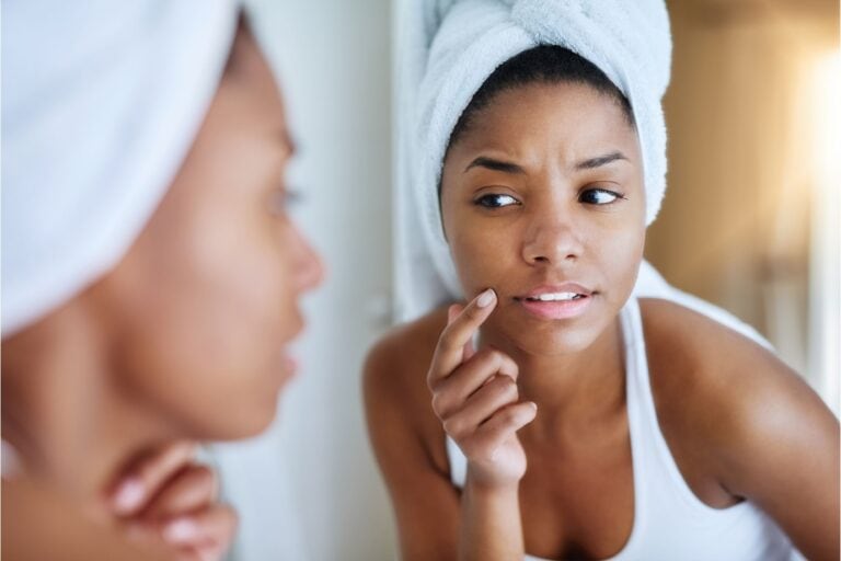 woman worried about her skin, skincare not providing good results
